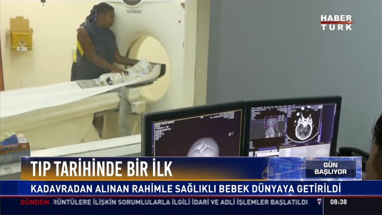 Tıp tarihinde bir ilk: Kadavradan alınan rahimle sağlıklı bebek dünyaya geldi