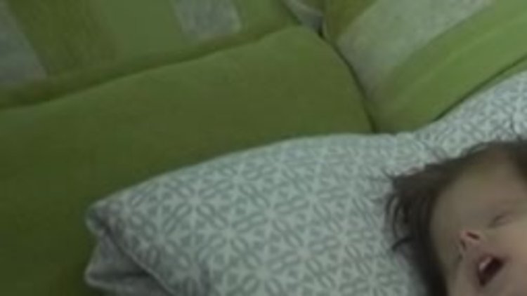 2 yaşındaki Hallerman-Streiff Sendromlu minik Hira yardım bekliyor