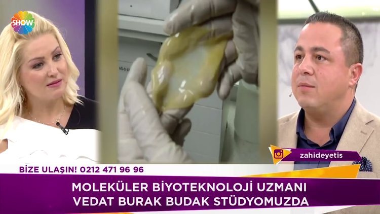 Yapay deri nerelerde kullanılıyor?