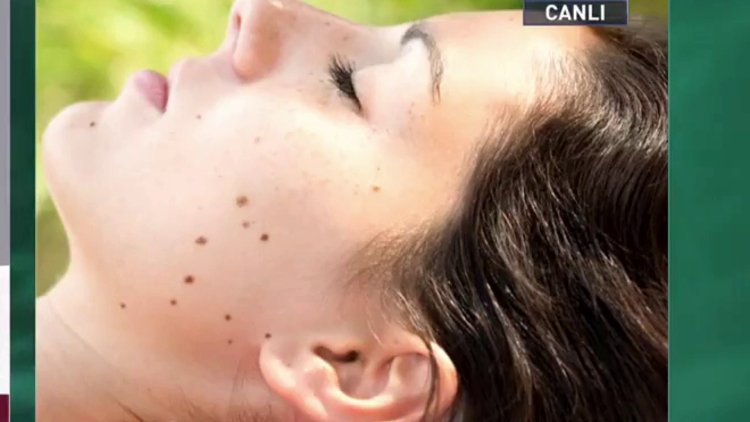 Benlerde görülen değişiklikler nelerdir?