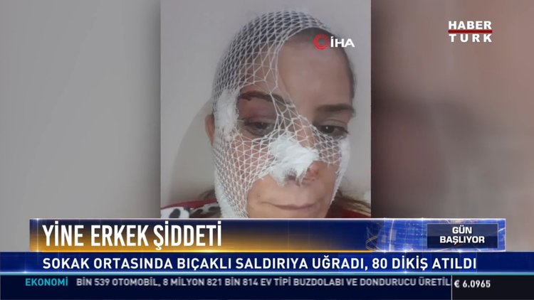 Yine erkek şiddeti: Adana'da kadın yüzünden ve ellerinden bıçaklandı