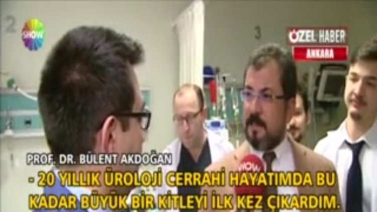 10 kiloluk böbrek şoke etti!