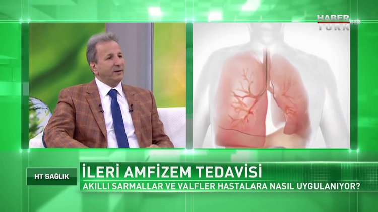 Koah hastalığında Valf yönteminde işlem süresi ne kadardır?