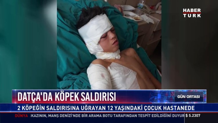 Datça'da köpek saldırısı:2 köpeğin saldırısına uğrayan 12 yaşındaki çocuk hastanede