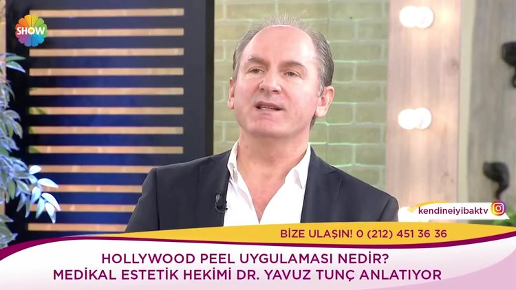 Hollywood peel uygulaması nedir?