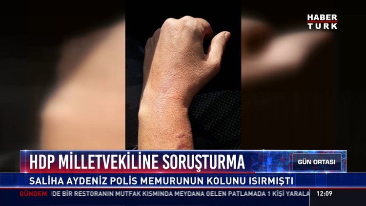 Hdp milletvekiline soruşturma: Saliha Aydeniz polis memurunun kolunu ısırmıştı