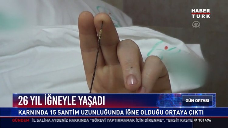 26 yıl iğneyle yaşadı