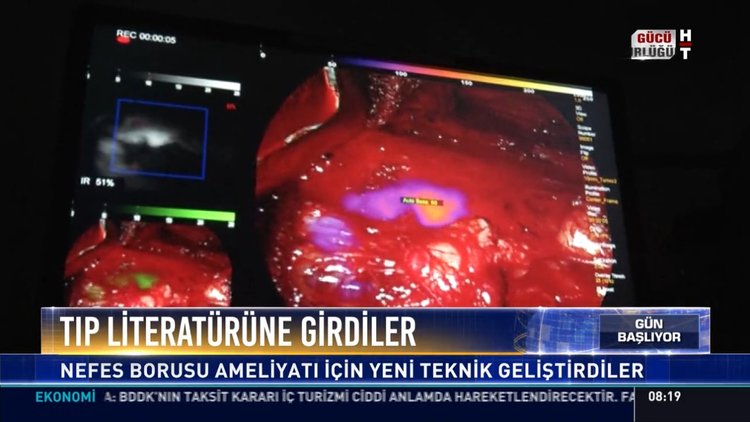 Tıp literatürüne girdiler: Nefes borusu ameliyatı için yeni teknik geliştirdiler