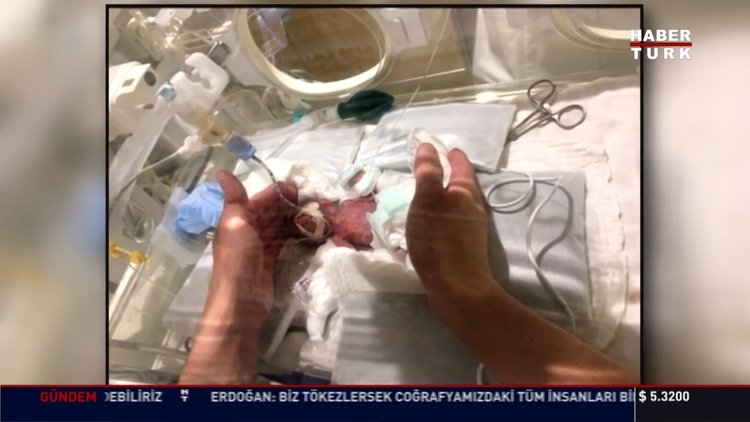 Doğduğunda iki avuca sığıyordu