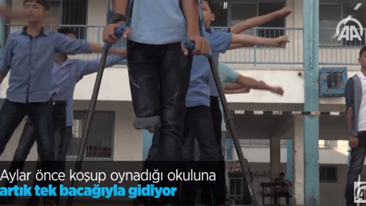 Aylar önce koşup oynadığı okuluna tek bacağıyla başladı