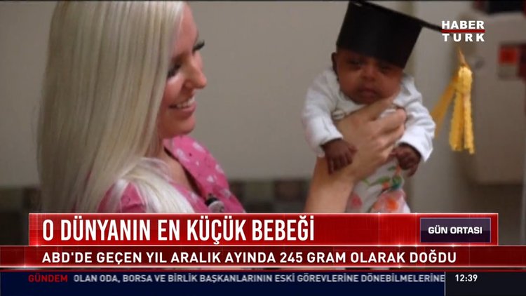 O dünyanın en küçük bebeği: ABD'de geçen yıl aralık ayında 245 gram olarak doğdu