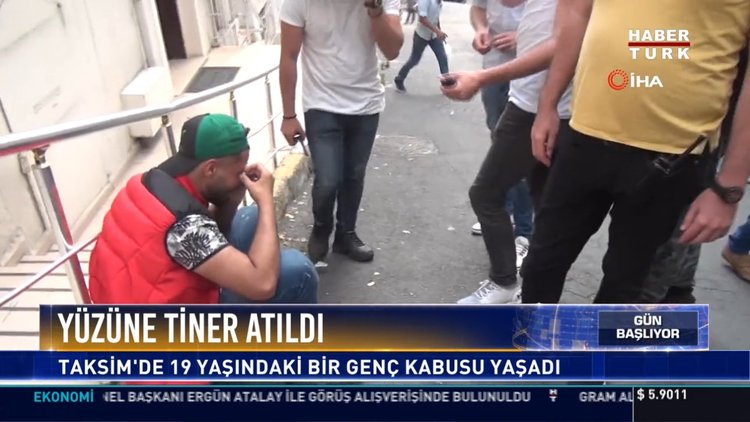 Yüzüne tiner atıldı