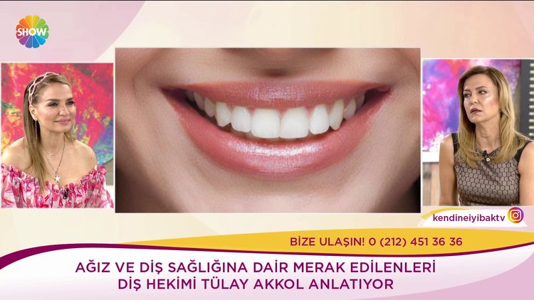 Diş beyazlatma nasıl olur?