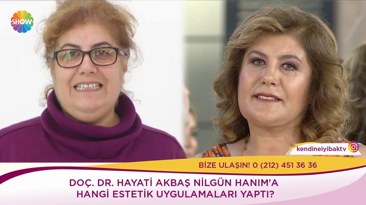 Nilgün Hanımın büyük değişimi