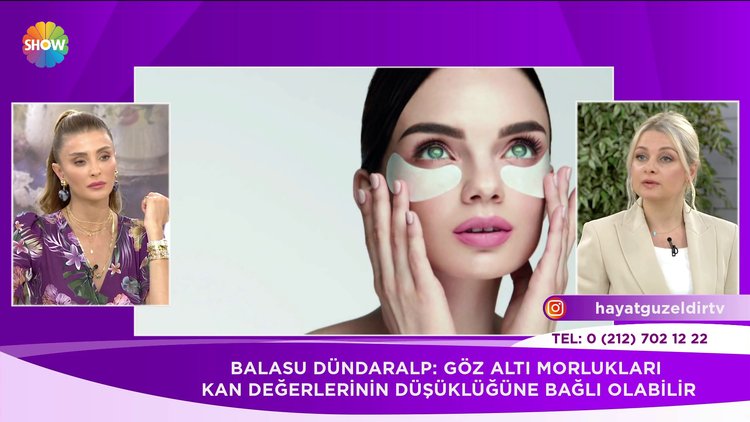 Göz altı morlukları'nın genel sebebi nelerdir?