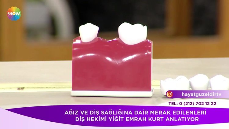 İmplant uygulaması nasıl yapılıyor?