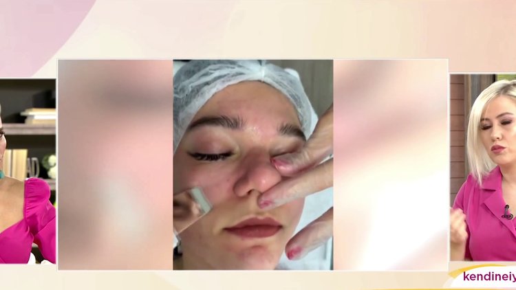 Amerikan cilt bakımı nedir?