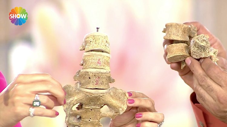 Kemik erimesi nedir?