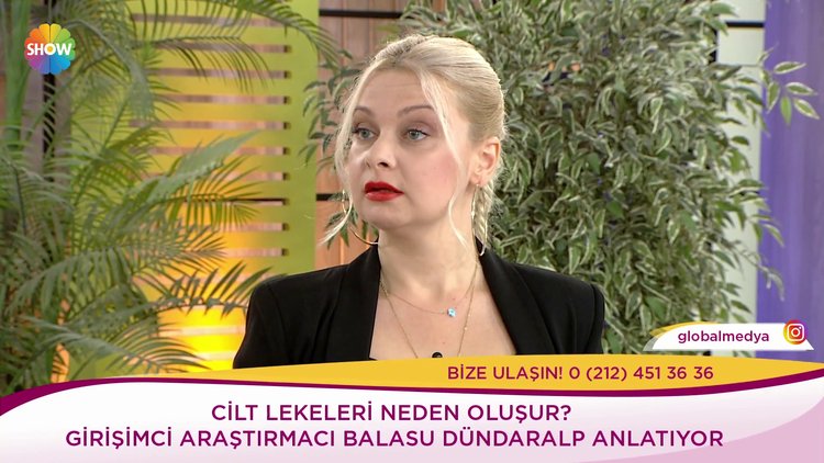 Cilt lekeleri neden oluşur?