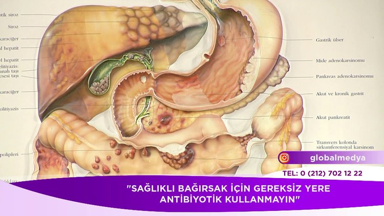 Sağlıklı bağırsaklar için öneriler