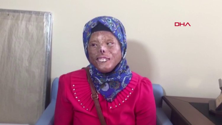 Yüz nakli bekleyen Leyla, Ömer Özkan'la görüşmek için Antalya'da