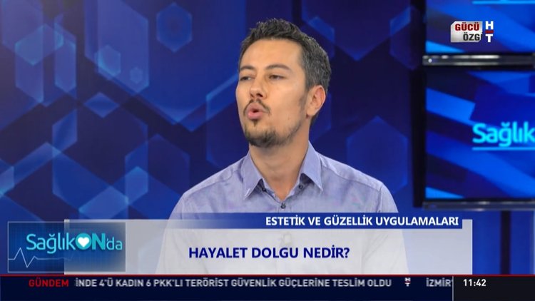 Hayalet dolgu nedir?