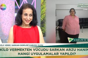 94 kilo veren Arzu Hanım'ın şaşırtan değişimi!
