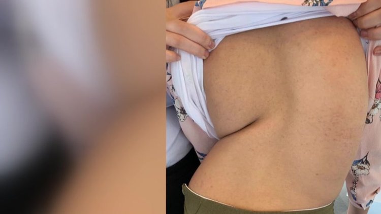 "Kızım Türkiye'de ikinci kez doğdu"