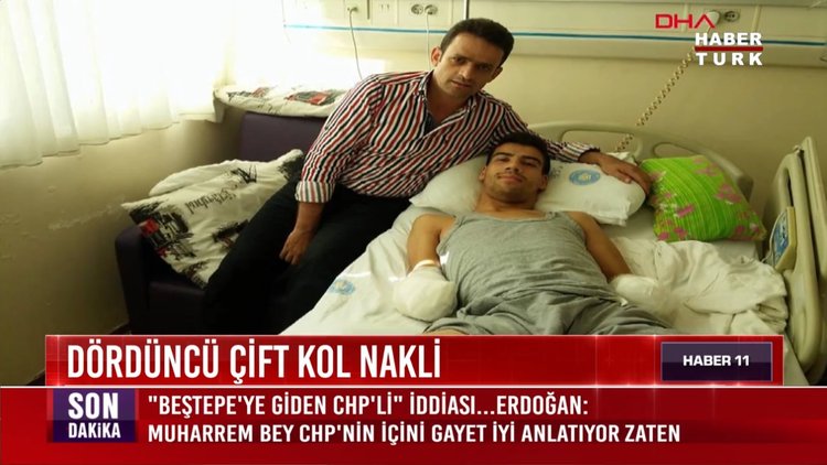 Dördüncü çift kol nakli