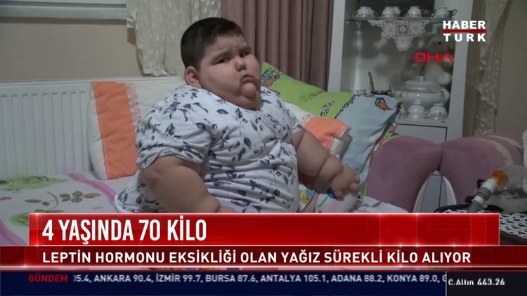 4 yaşında 7 kilo