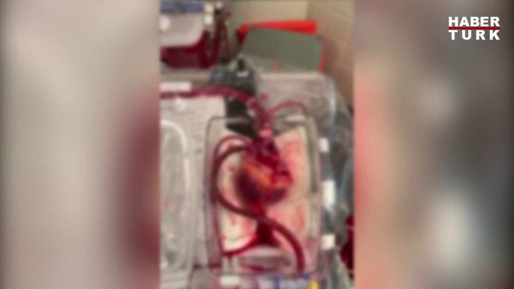 İlk kez durmuş bir kalp nakli yapıldı