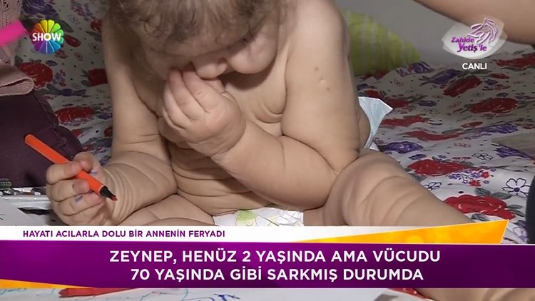 Küçük Zeynep'in amansız hastalığı!