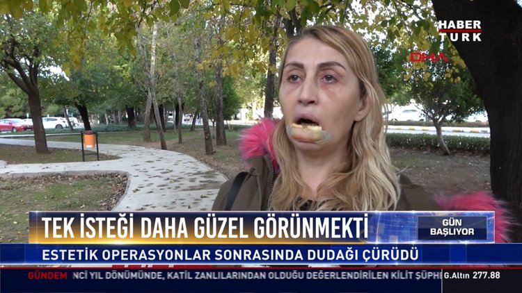 Tek isteği daha güzel görünmekti