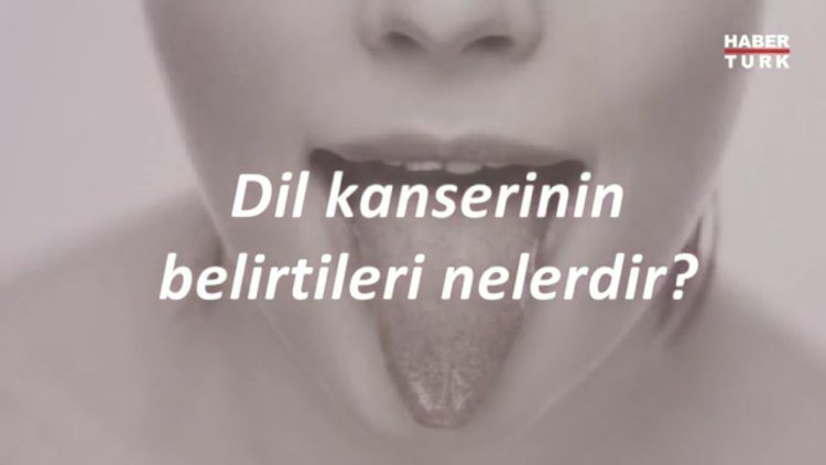 Dil kanseri neden ortaya çıkar? Dil kanseri belirtileri nelerdir?