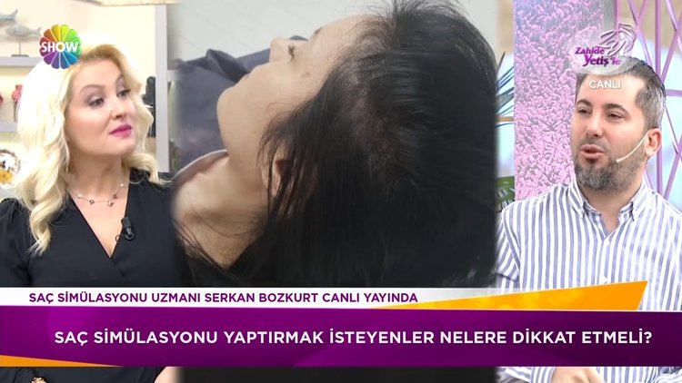 Saç simülasyonu yaptırmak isteyenler nelere dikkat etmeli?