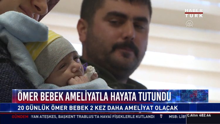 Ömer bebek ameliyatla hayata tutundu