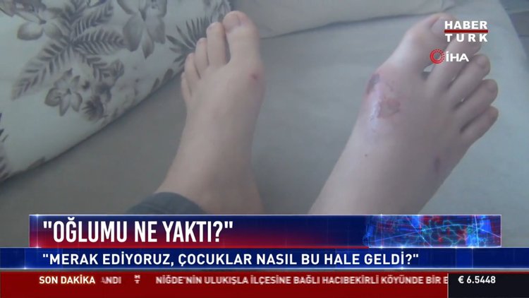 Kartopu oynayan çocukların yanması