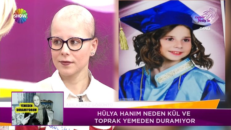 Gülçin'in saç ve kirpikleri neden bir anda döküldü?