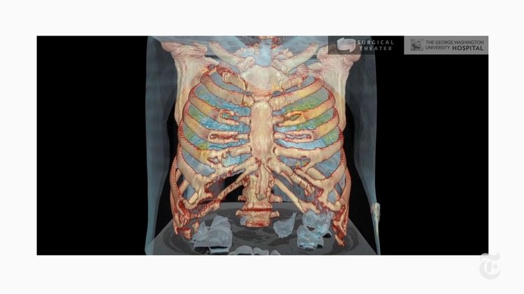 New York Times koronavirüsün akciğeri nasıl istila ettiğini gösterdi