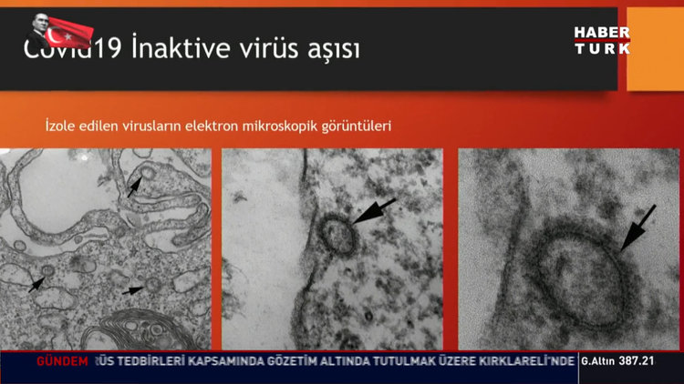 Prof. Dr. Ercüment Ovalı Habertürk'te