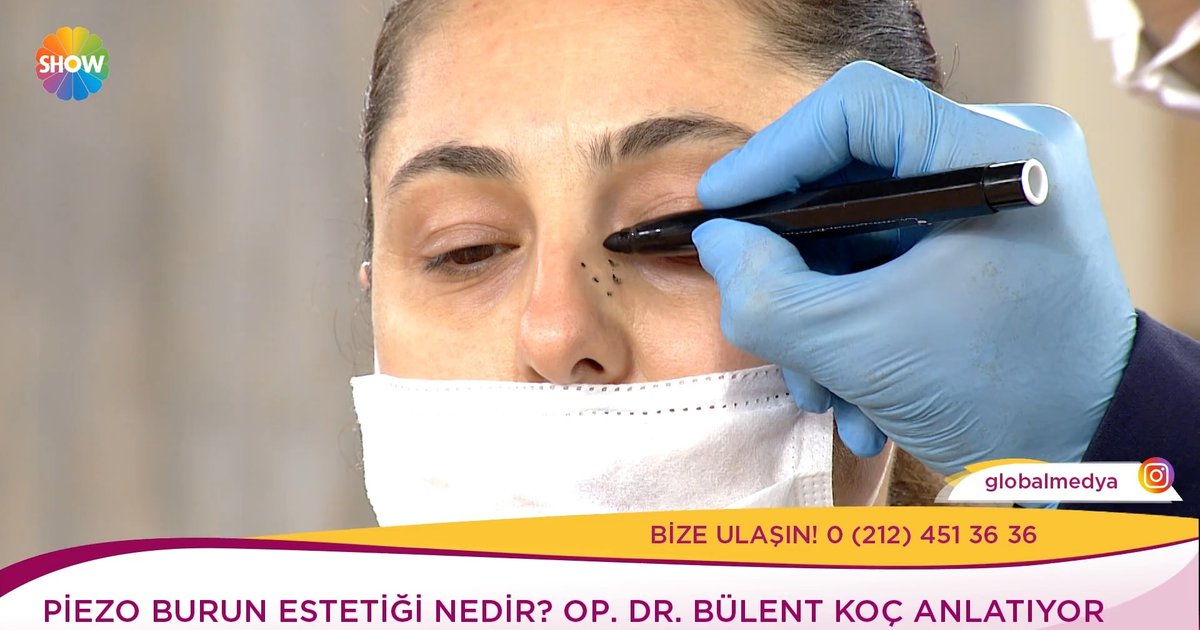 Kendine Iyi Bak Videolari Piezo Burun Estetigi Nasil Yapilir