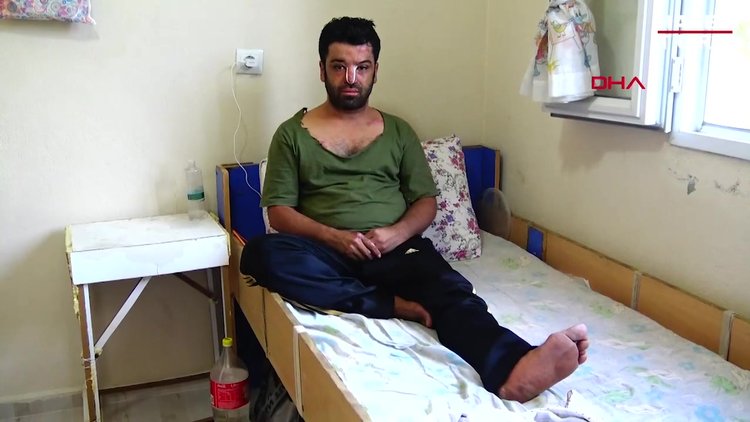 Epilepsi nöbeti sonrası sıcak suya düşen Bilal, eski haline dönmek istiyor