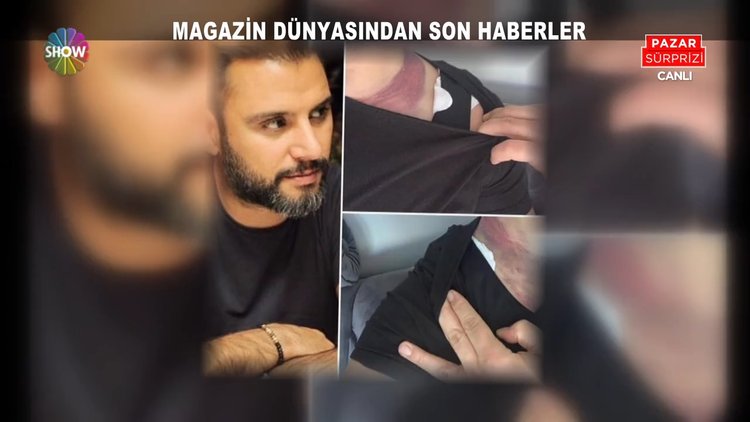 Alişan ölümden döndü!