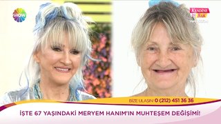 67 yaşındaki Meryem Hanım'a yapılan uygulamalar ve Meryem Hanım'ın değişimi ekranlara geldi