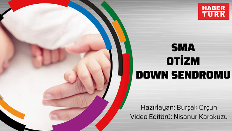 SMA, Otizm, Down Sendromu