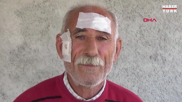 Başına isabet eden 'yorgun saçmalar' nedeniyle yaralandı