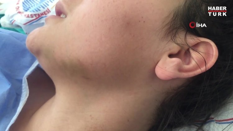 Yediği dayaklara dayanamayıp 3. kattan atlamıştı... Çocuk gelin Fatma yaşananları böyle anlattı