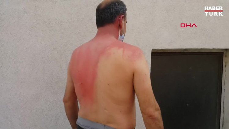 Sigara dumanı nedeniyle tartıştığı komşusunun üzerine kaynar su döktü