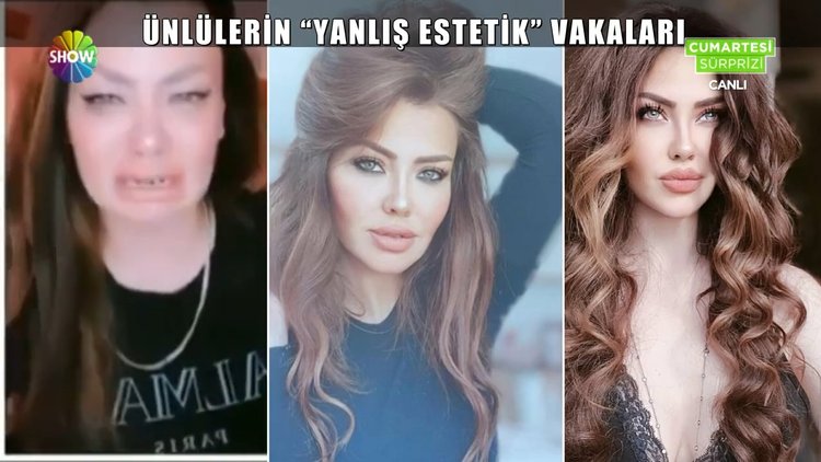 Ünlülerin estetik faciaları!
