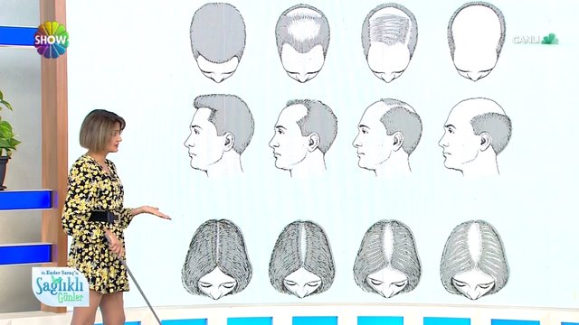 4w58f bmm1nfzm 4w58f bmm1nfzm